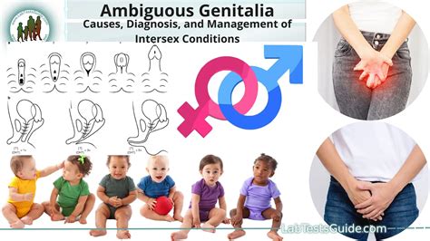 hermaphrodite pictures|Intersex Ambiguous Genitalia Variations – Pictures .